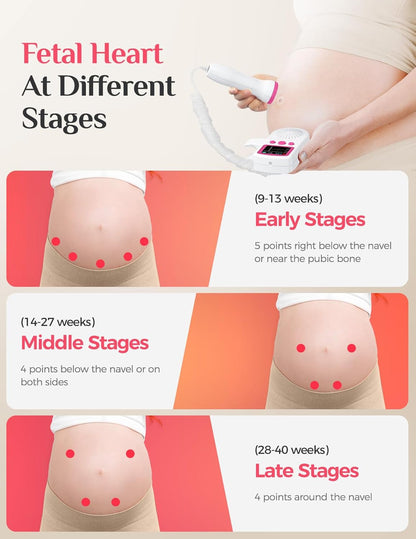 Heartbeat Harmony Fetal Monitor